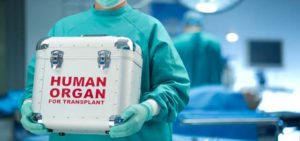 organ donation